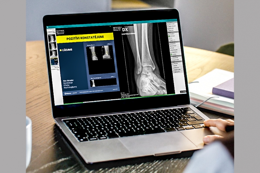 Kurzeme: Rentgena diagnostikā izmanto mākslīgo intelektu